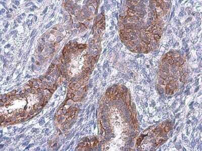 Immunohistochemistry-Paraffin: EGFR [p Tyr998] Antibody [NBP3-13267]